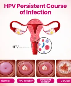 Cpviat® IntiDefend Anti-HPV Interferon Gel
