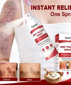 Cpviat ® 7-Day Dry Flaky Painless & Scar-Free Gentle Advanced Itch Calming Beef Tallow Spray