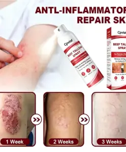 Cpviat ® 7-Day Dry Flaky Painless & Scar-Free Gentle Advanced Itch Calming Beef Tallow Spray