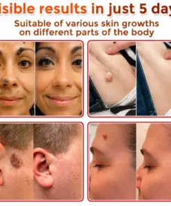 Cpviat™ ClearTag Microneedle Skin Tag Patch