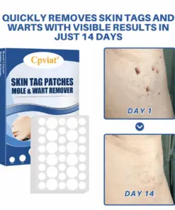 Cpviat® Moles & Warts Removing Skin Tag Patch