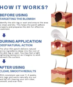 Cpviat® Moles & Warts Removing Skin Tag Patch