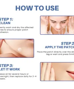 Cpviat® Moles & Warts Removing Skin Tag Patch