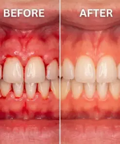 Cpviat™ Teeth Whitening & Repair Gel Teeth Repair Pen
