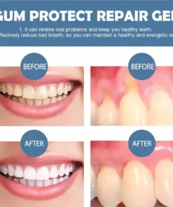 Cpviat™ Teeth Whitening & Repair Gel Teeth Repair Pen